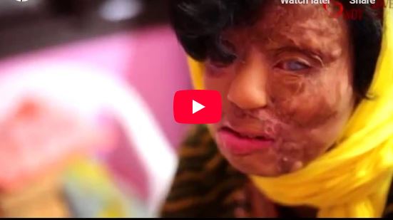 Speech of Dr. Hari Prasad Kanoria, Chairman, ASWWF (Acid Survivors & Women Welfare Foundation)