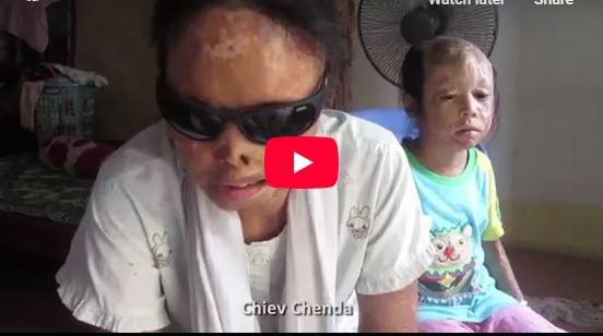 Speech of Dr. Hari Prasad Kanoria, Chairman, ASWWF (Acid Survivors & Women Welfare Foundation)