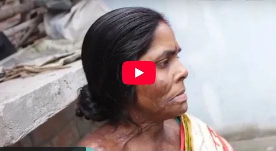 Speech of Dr. Hari Prasad Kanoria, Chairman, ASWWF (Acid Survivors & Women Welfare Foundation)